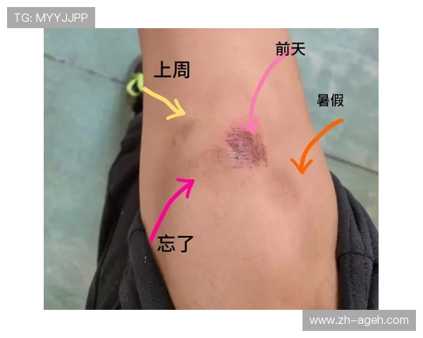 羽毛球膝盖无力